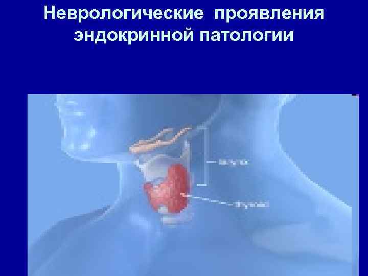 Неврологические проявления эндокринной патологии 