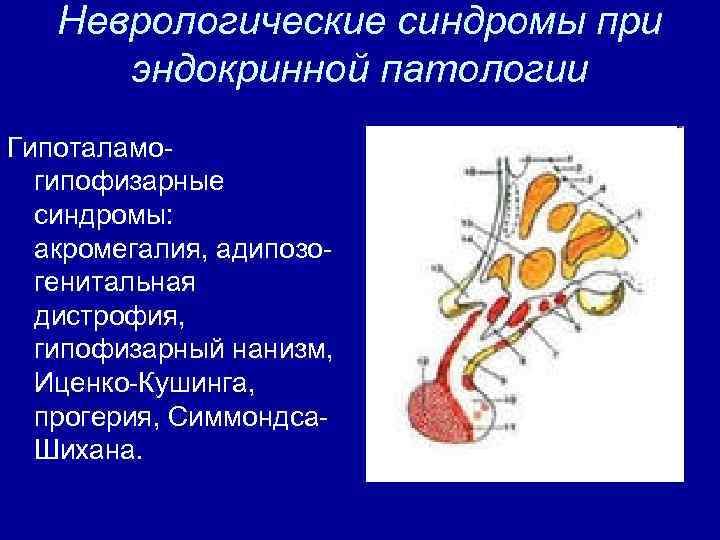 Неврологические синдромы при эндокринной патологии Гипоталамо гипофизарные синдромы: акромегалия, адипозо генитальная дистрофия, гипофизарный нанизм,