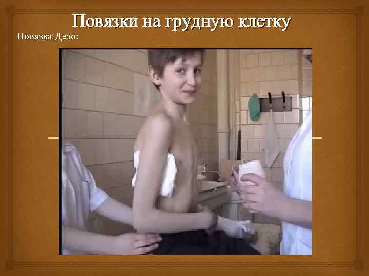 Повязки на грудную клетку Повязка Дезо: 