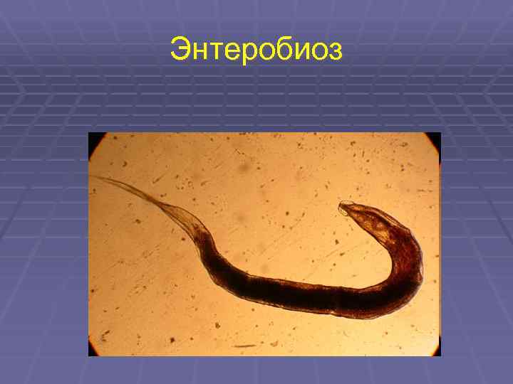 Энтеробиоз 