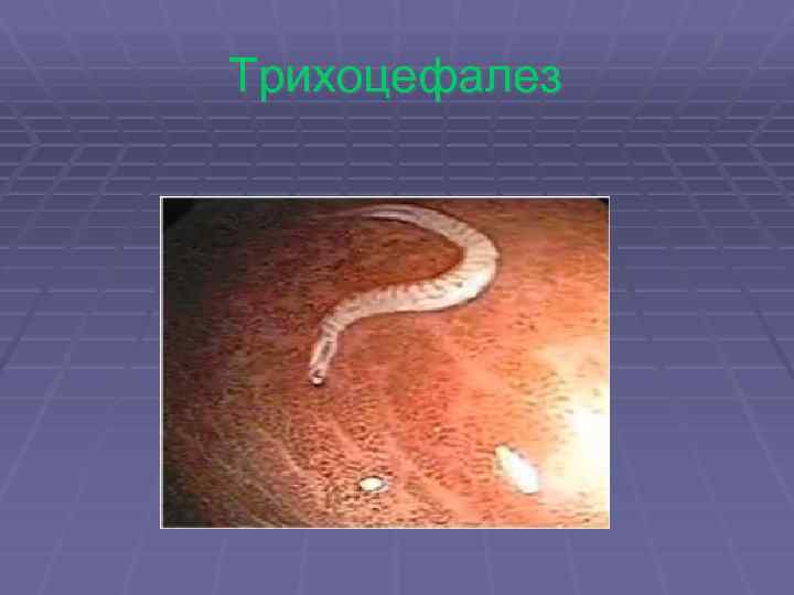 Трихоцефалез 