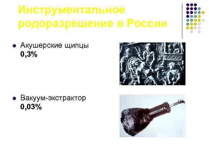 Инструментальное родоразрешение в России l Акушерские щипцы 0, 3% l Вакуум-экстрактор 0, 03% 