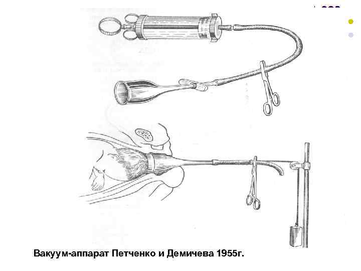 Вакуум-аппарат Петченко и Демичева 1955 г. 