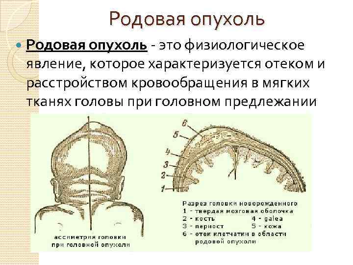 Родовая опухоль - это физиологическое явление, которое характеризуется отеком и расстройством кровообращения в мягких