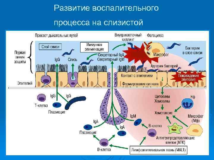 Развитие воспалительного процесса на слизистой 