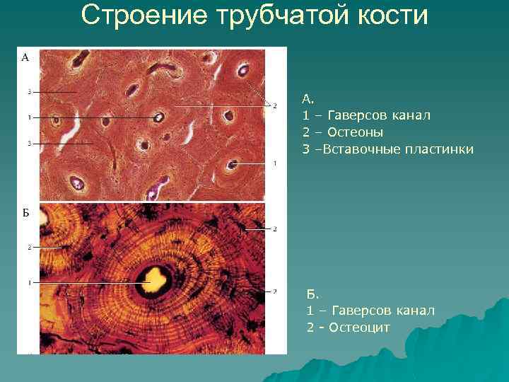 Строение трубчатой кости А. 1 – Гаверсов канал 2 – Остеоны 3 –Вставочные пластинки