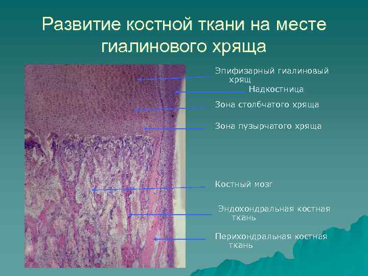 Ткань латынь. Грубоволокнистая костная ткань костная ткань. Строение надкостницы гистология. Формирование костной ткани на месте хряща. Зона столбчатого хряща.