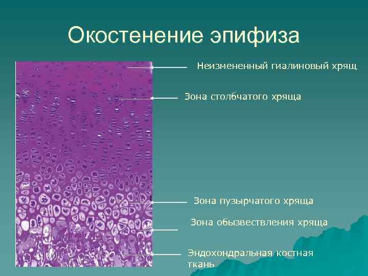 Окостенение эпифиза Неизмененный гиалиновый хрящ Зона столбчатого хряща Зона пузырчатого хряща Зона обызвествления хряща