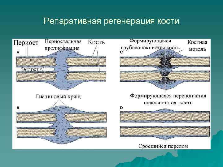 Репаративная регенерация кости 