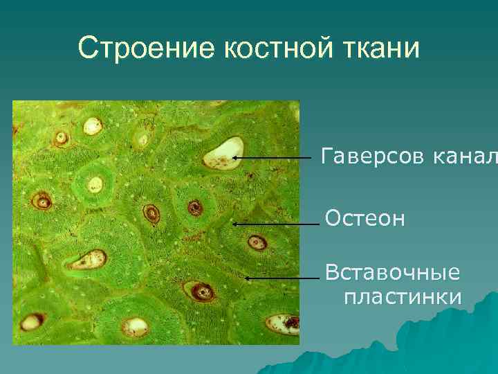 Канал костной ткани. Пластинчатая костная ткань препарат. Строение пластинчатой костной ткани. Вставочные пластинки остеона. Вставочные пластинки костной ткани.