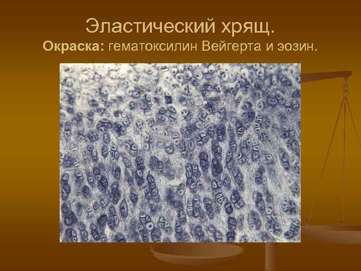 Эластический хрящ. Окраска: гематоксилин Вейгерта и эозин. 