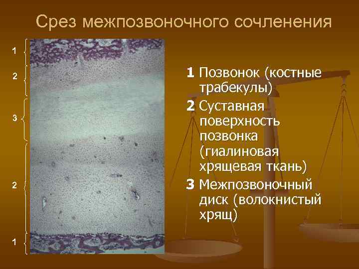 Срез межпозвоночного сочленения 1 2 3 2 1 1 Позвонок (костные трабекулы) 2 Суставная