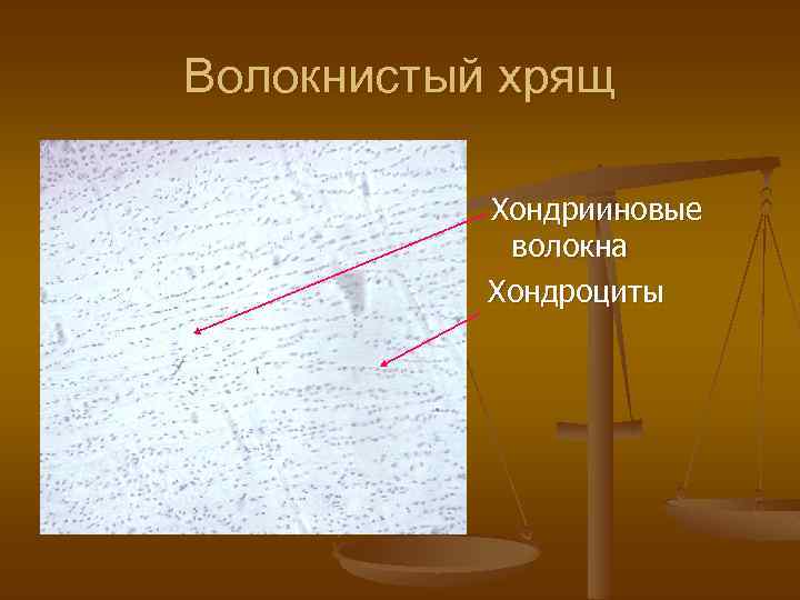 Волокнистый хрящ Хондрииновые волокна Хондроциты 