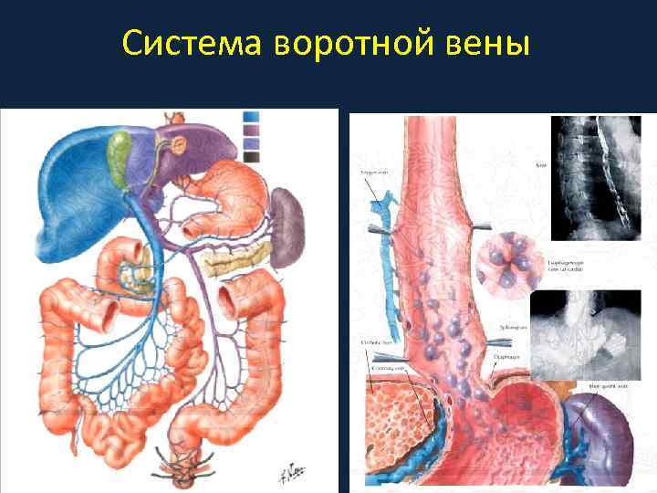 Система воротной вены 