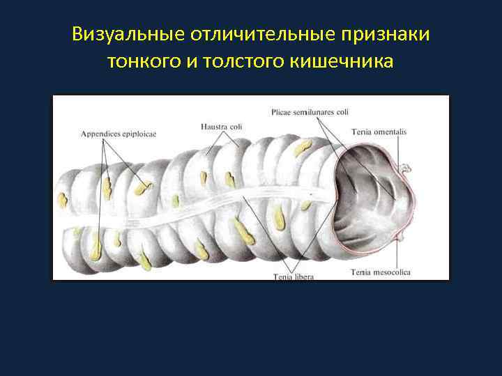 Визуальные отличительные признаки тонкого и толстого кишечника 