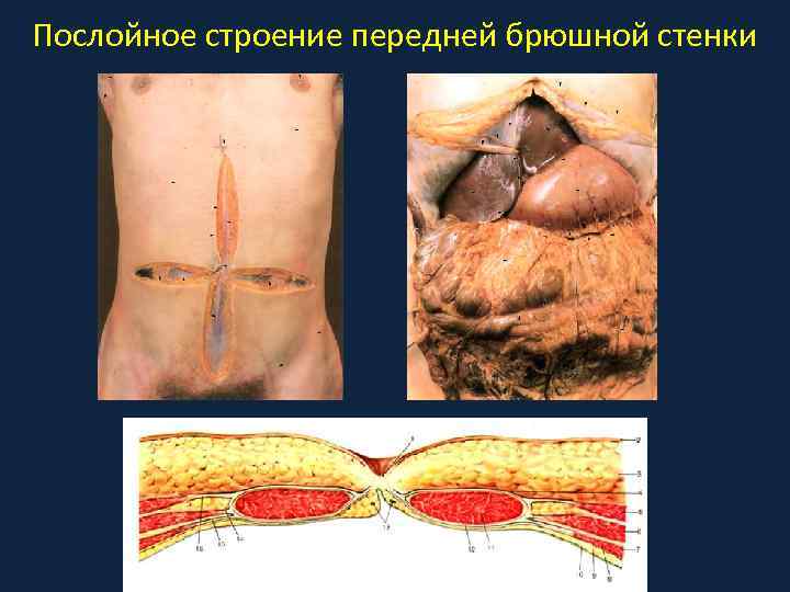 Послойное строение передней брюшной стенки 