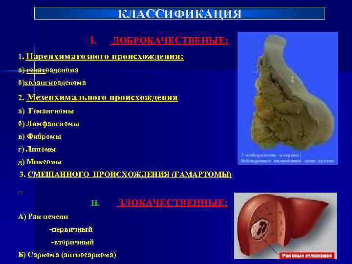 Синдром повреждения паренхиматозных органов брюшной полости. Паренхиматозные опухоли. Паренхиматозные опухоли классификация. Паренхиматозное воспаление.