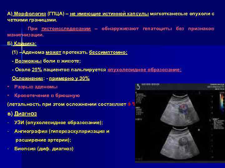 А) Морфология (ГПЦА) – не имеющие истинной капсулы мягкотканевые опухоли с четкими границами. При
