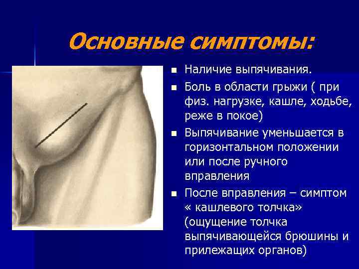 Основные симптомы: n n Наличие выпячивания. Боль в области грыжи ( при физ. нагрузке,