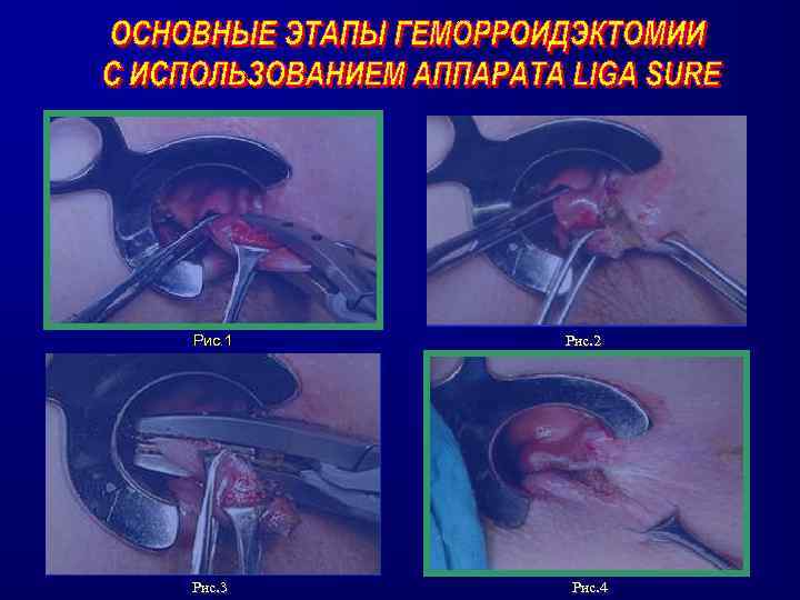 Рис. 1 Рис. 3 Рис. 2 Рис. 4 