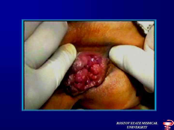 ROSTOV STATE MEDICAL UNIVERSITY 