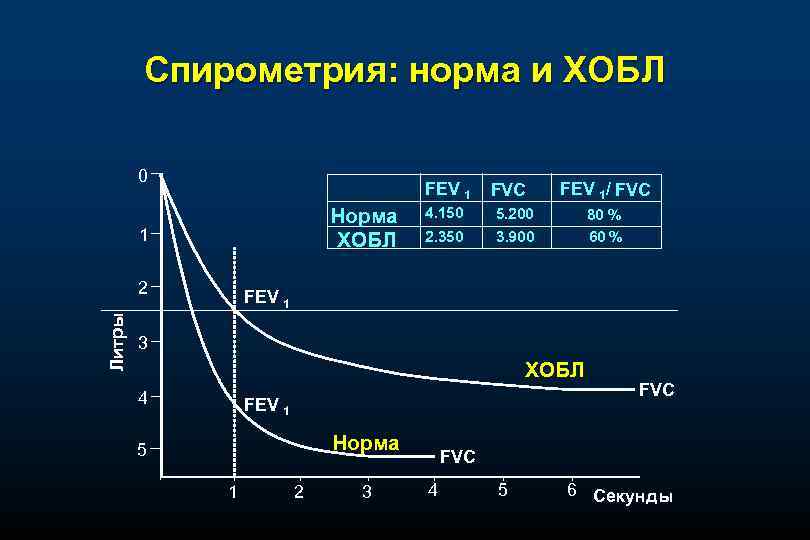 Спирометрия: норма и ХОБЛ 0 FEV 1 Норма ХОБЛ 1 Литры 2 FVC FEV