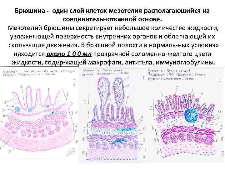 Брюшина - один слой клеток мезотелия располагающийся на соединительнотканной основе. Мезотелий брюшины секретирует небольшое