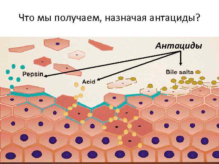Что мы получаем, назначая антациды? Антациды 