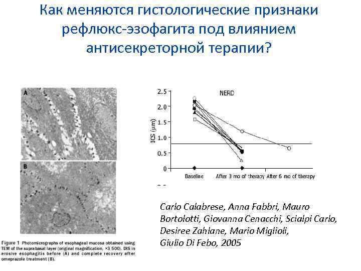 Как меняются гистологические признаки рефлюкс-эзофагита под влиянием антисекреторной терапии? Carlo Calabrese, Anna Fabbri, Mauro