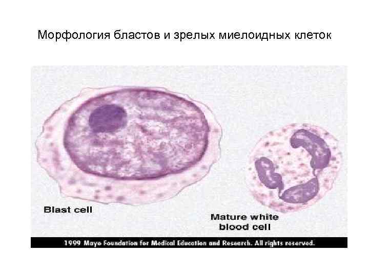 Морфология бластов и зрелых миелоидных клеток 