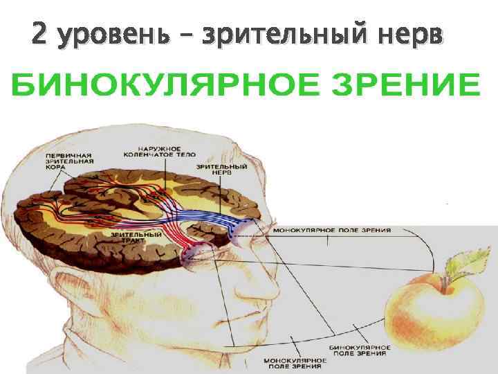 2 уровень – зрительный нерв 