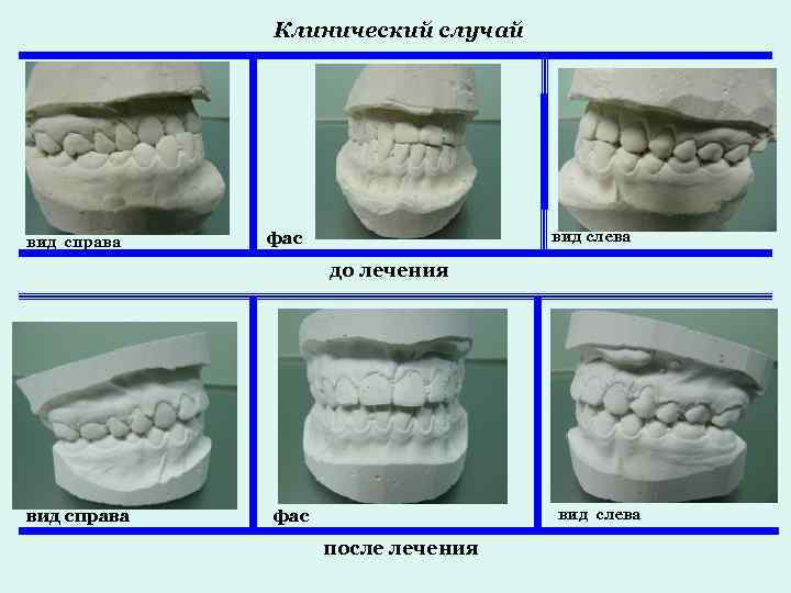 Вид случай