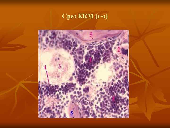 Срез ККМ (г-э) 