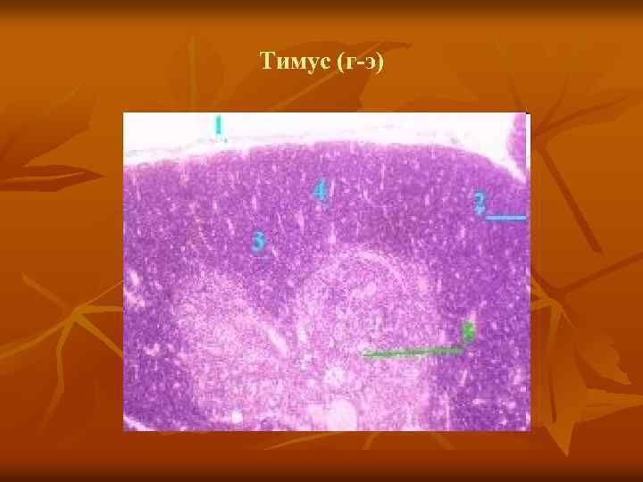 Тимус (г-э) 