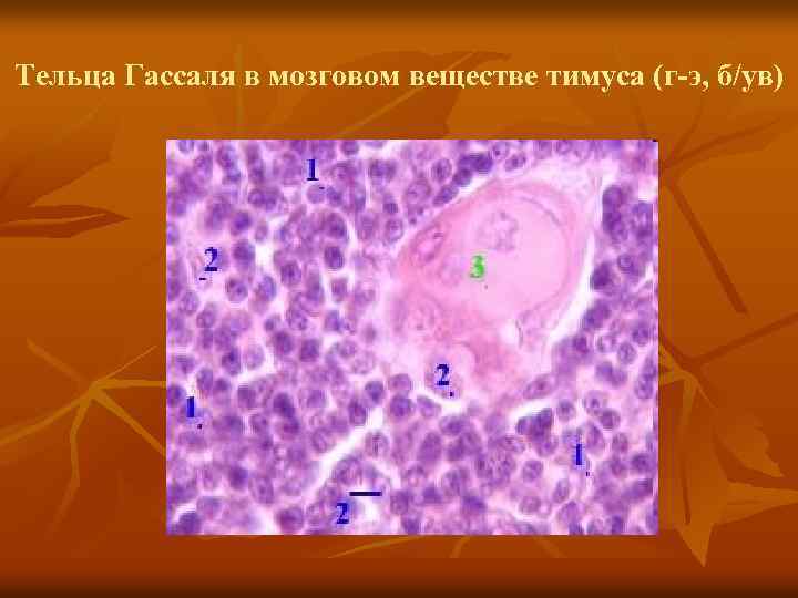 Тельца Гассаля в мозговом веществе тимуса (г-э, б/ув) 