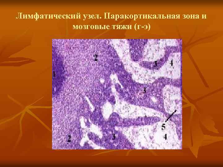 Лимфатический узел. Паракортикальная зона и мозговые тяжи (г-э) 