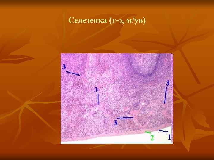 Селезенка (г-э, м/ув) 