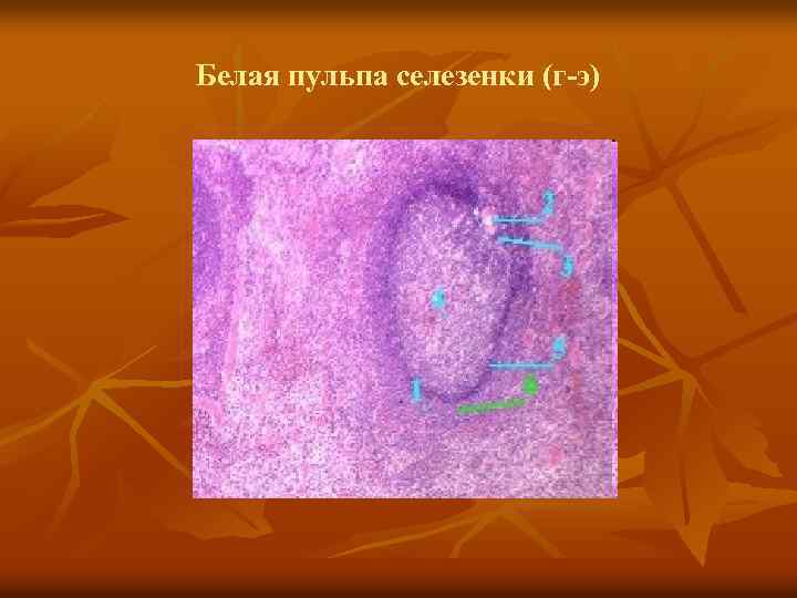 Белая пульпа селезенки (г-э) 