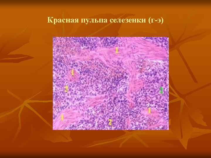 Красная пульпа селезенки (г-э) 