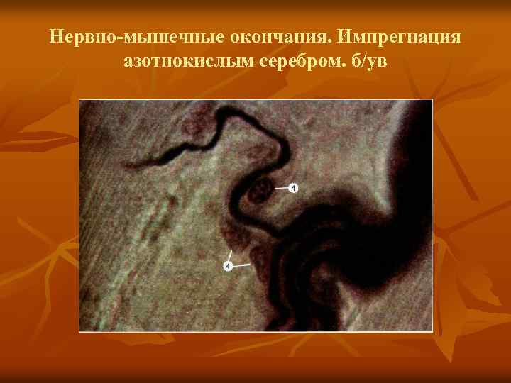 Нервно-мышечные окончания. Импрегнация азотнокислым серебром. б/ув 
