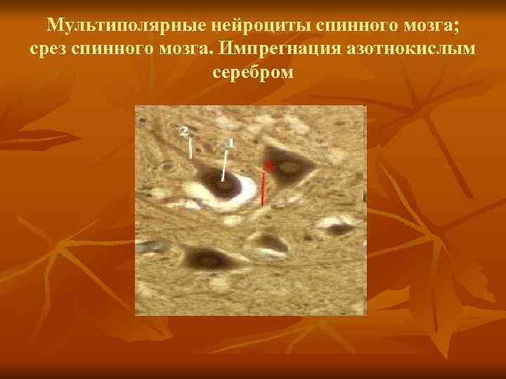 Мультиполярные нейроциты спинного мозга; срез спинного мозга. Импрегнация азотнокислым серебром 