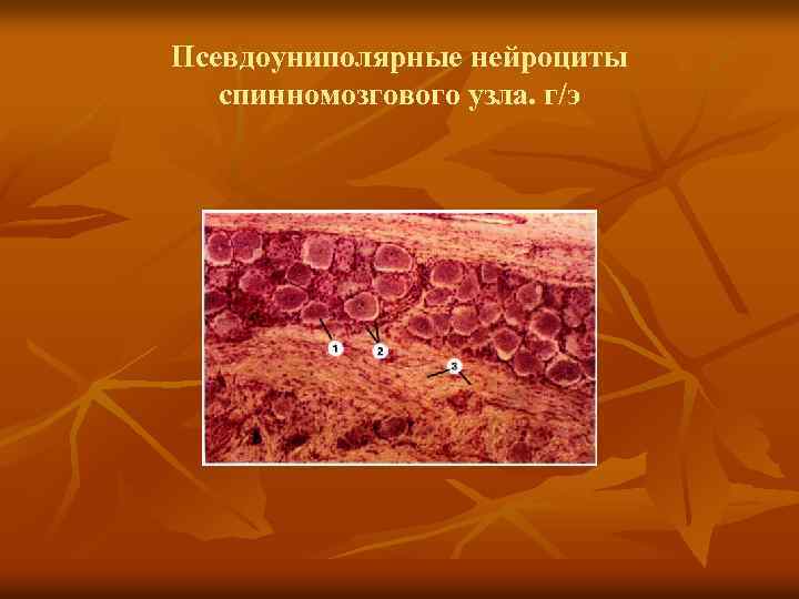 Псевдоуниполярные нейроциты спинномозгового узла. г/э 