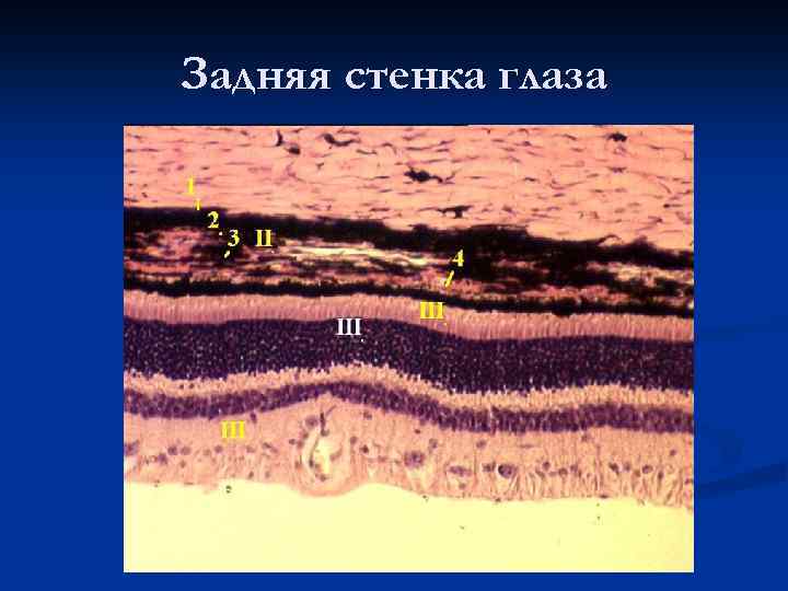 Задняя стенка глаза 