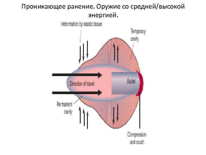 Проникающее ранение. Оружие со средней/высокой энергией. 