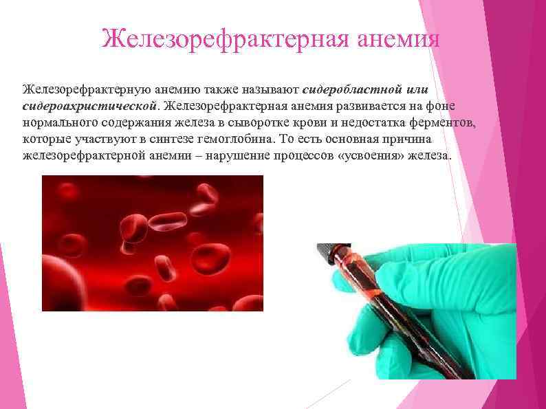 Железорефрактерная анемия Железорефрактерную анемию также называют сидеробластной или сидероахристической. Железорефрактерная анемия развивается на фоне