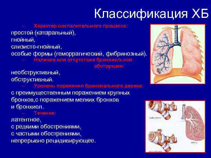 Классификация ХБ – Характер воспалительного процесса: простой (катаральный), гнойный, слизисто-гнойный, особые формы (геморрагический, фибринозный).