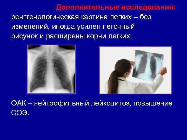 Дополнительные исследования: рентгенологическая картина легких – без изменений, иногда усилен легочный рисунок и расширены