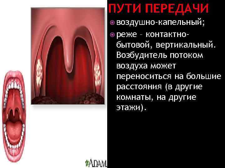 ПУТИ ПЕРЕДАЧИ воздушно-капельный; реже – контактнобытовой, вертикальный. Возбудитель потоком воздуха может переноситься на большие