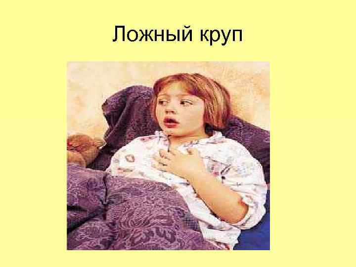 Ложный круп 