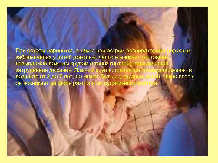 При остром ларингите, а также при острых респираторных вирусных заболеваниях у детей довольно часто